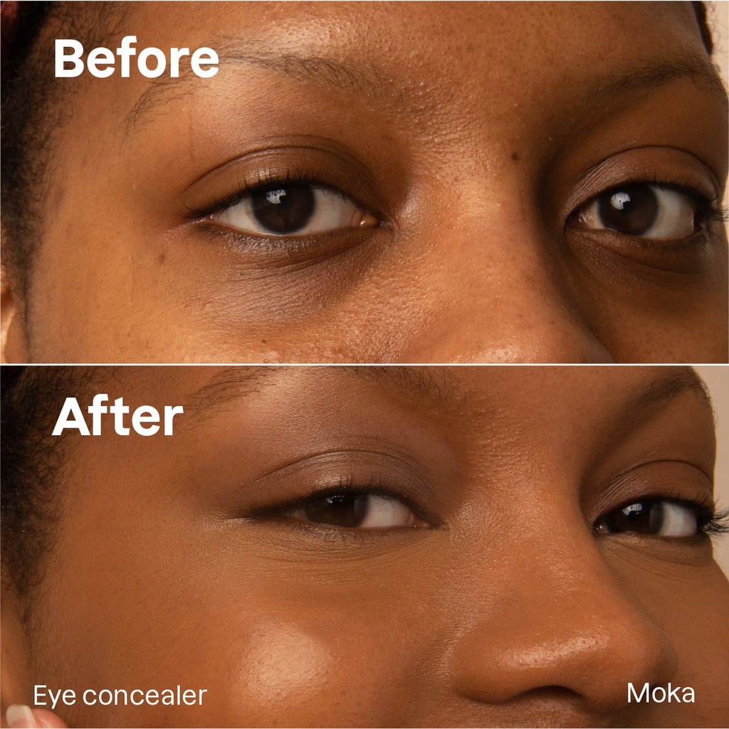 Shavelo - Concealer